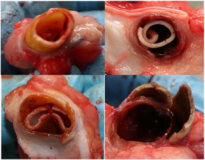 Experimental comparative study of a novel drug-eluting arteriovenous graft in a sheep model